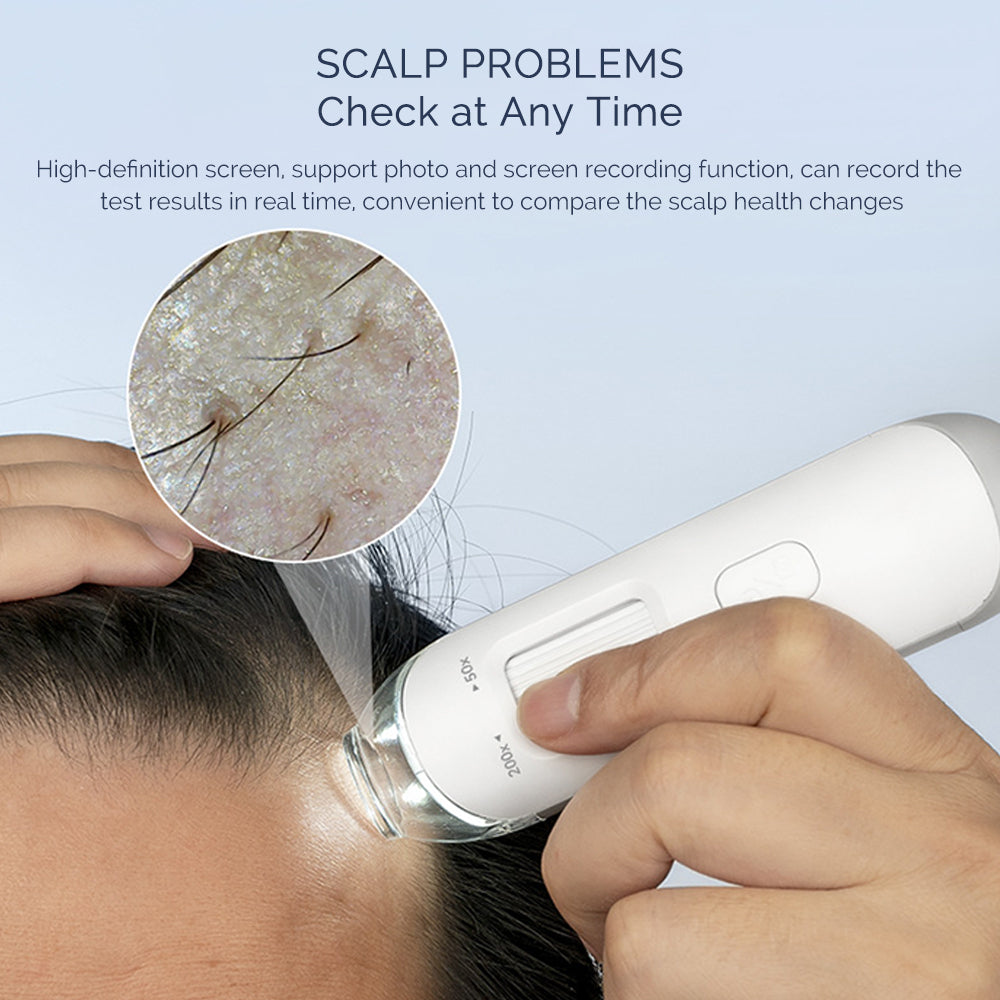 Smart Portable Scalp Hair Follicle Detector