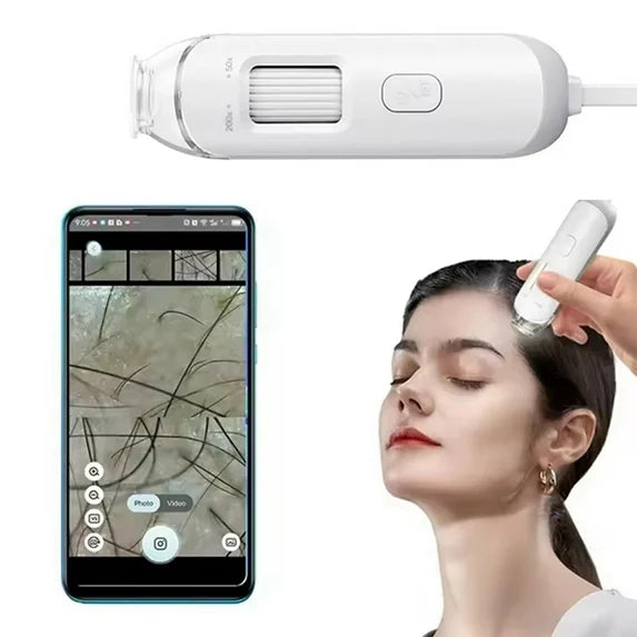 Smart Portable Scalp Hair Follicle Detector