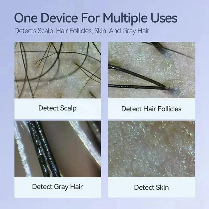 Smart Portable Scalp Hair Follicle Detector
