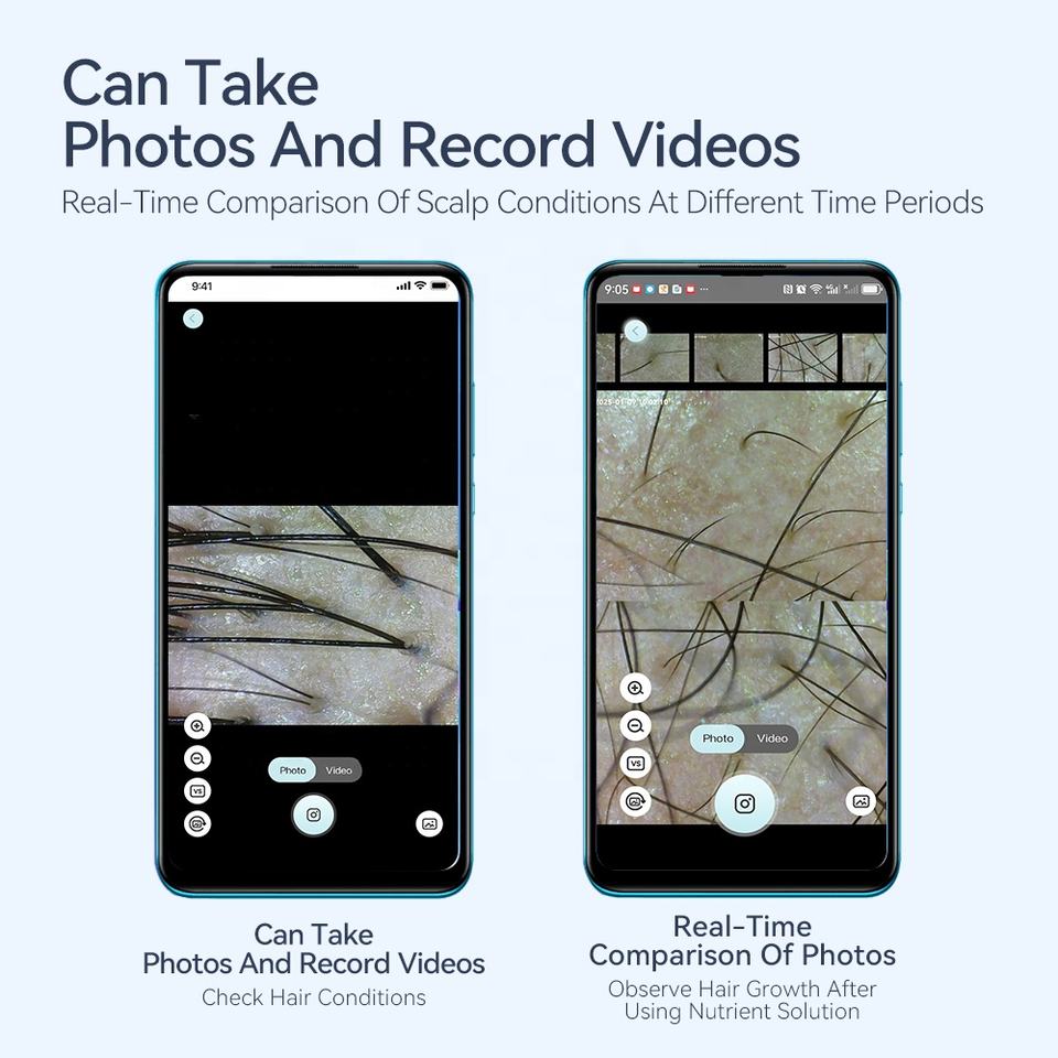 Smart Portable Scalp Hair Follicle Detector