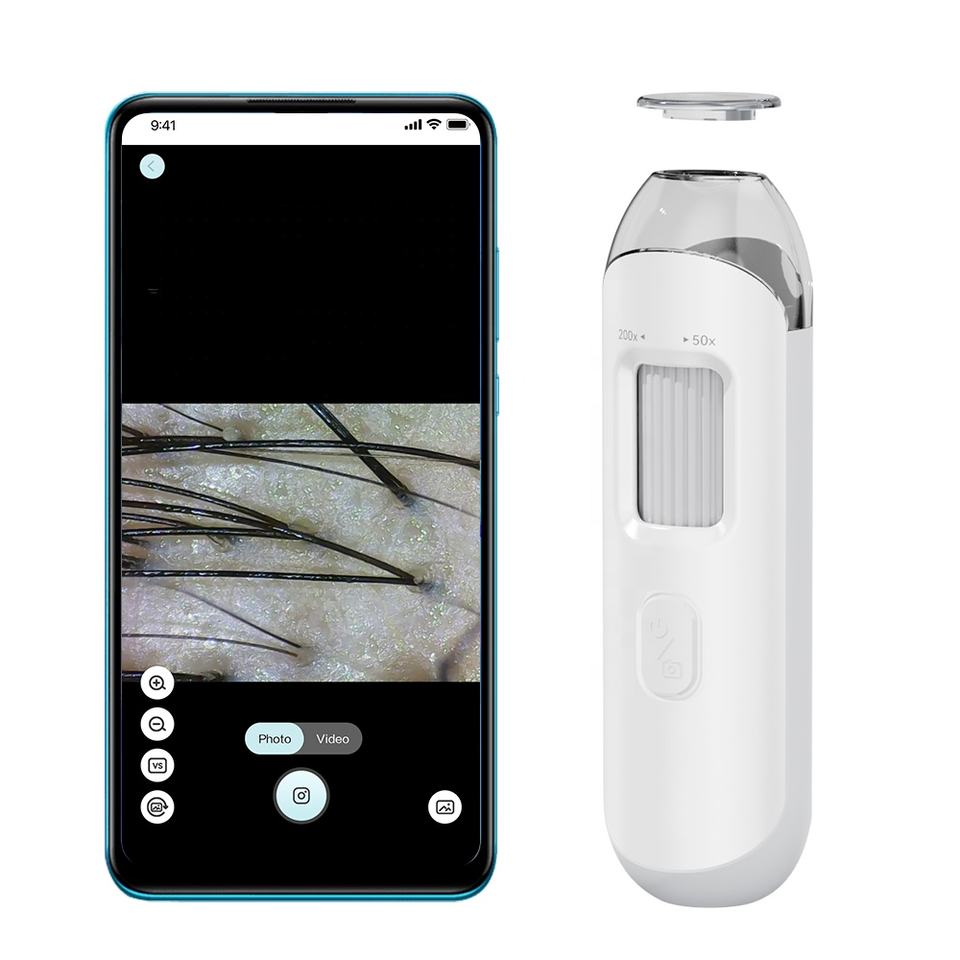 Smart Portable Scalp Hair Follicle Detector
